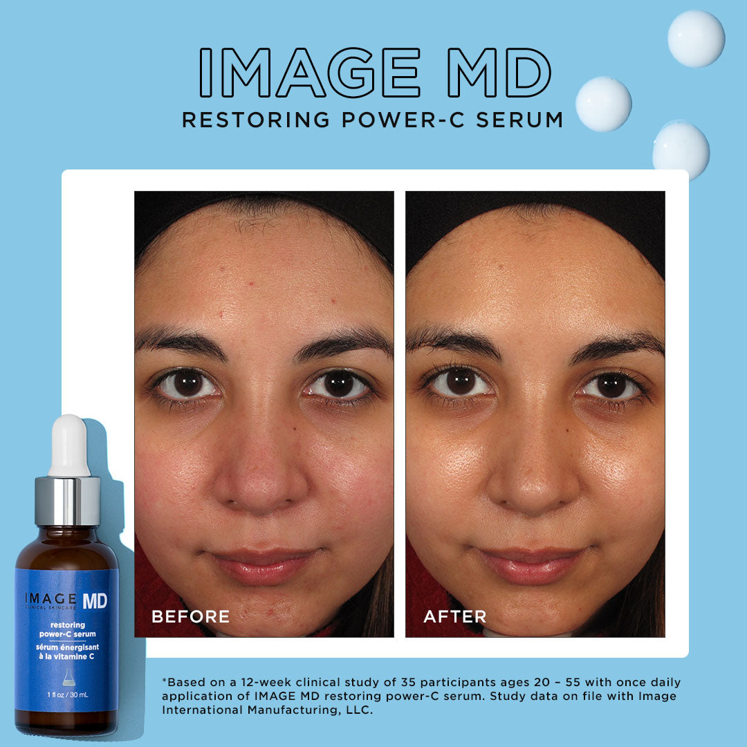 IMAGE MD Restoring Power-C Serum  - 28.4g MD-224